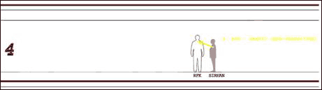 Bullet # 4 , RFK (Armpit, non-transiting)