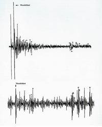 Oscillogram of test shot fired from grassy knoll (top) and sound pattern on DPD recording (bottom)